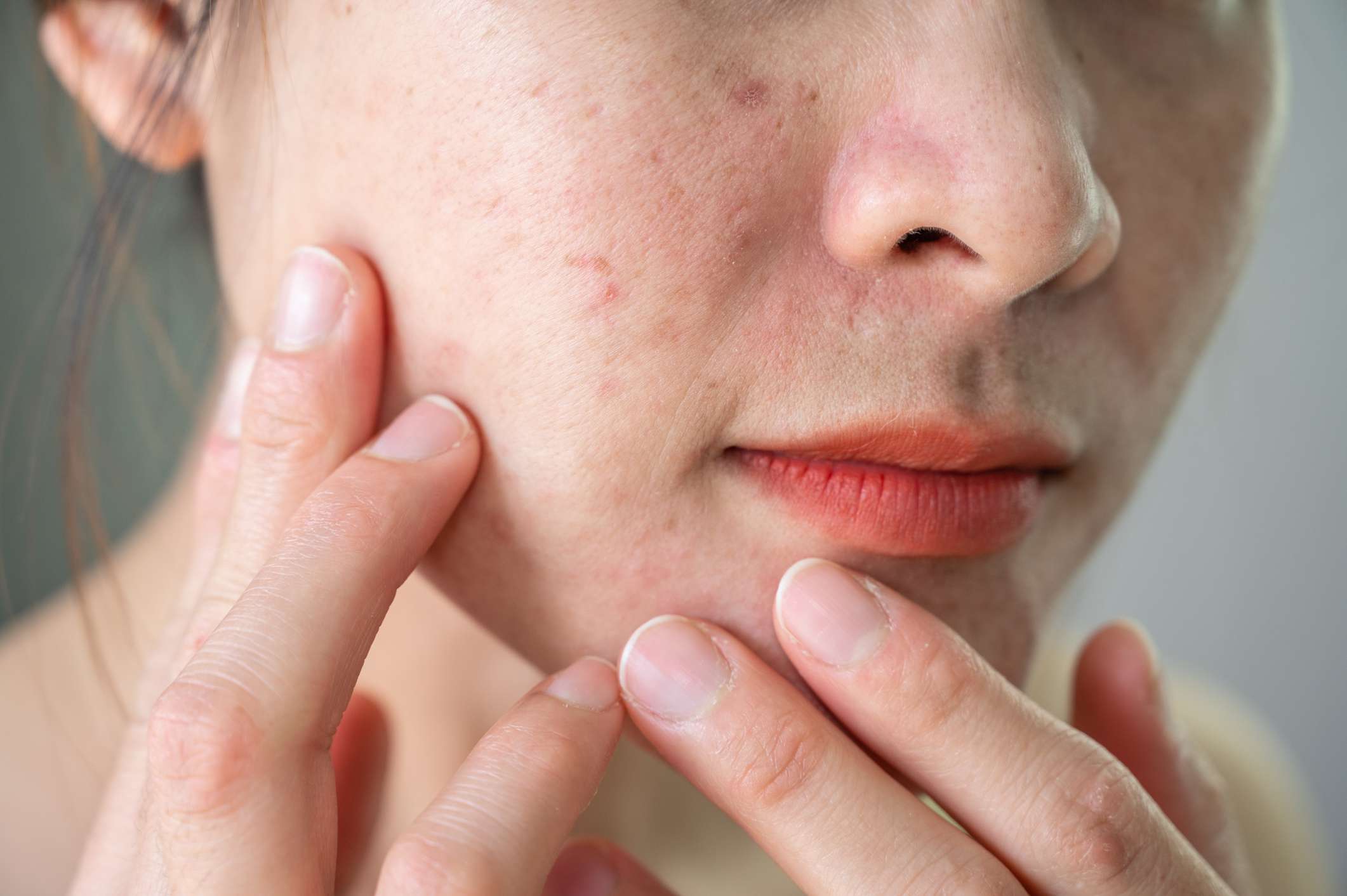 SIGNS YOUR SKIN BARRIER IS DAMAGED (AND WHAT YOUR SKIN IS TRYING TO TELL YOU)
